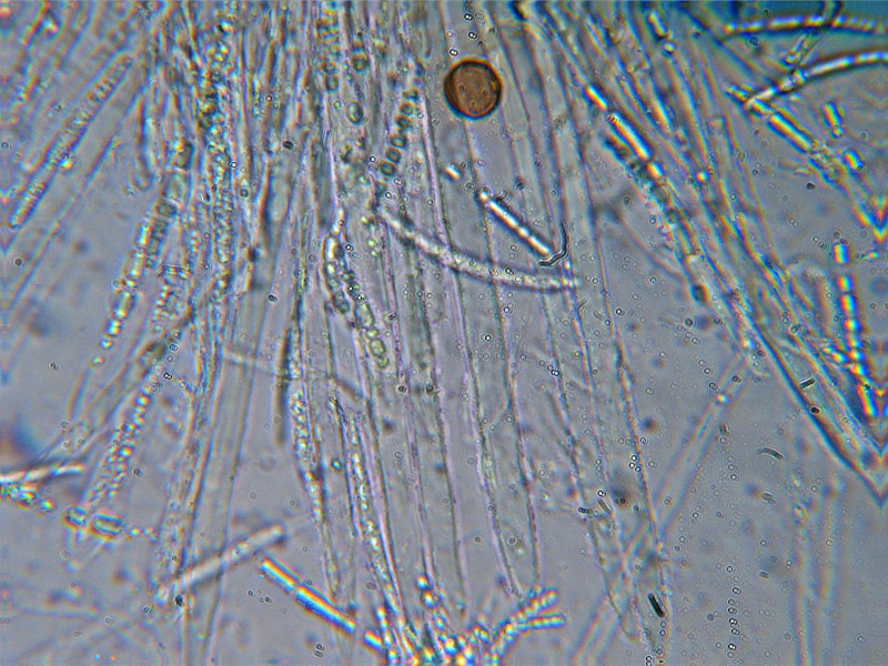 Dasyscyphus sulfureus